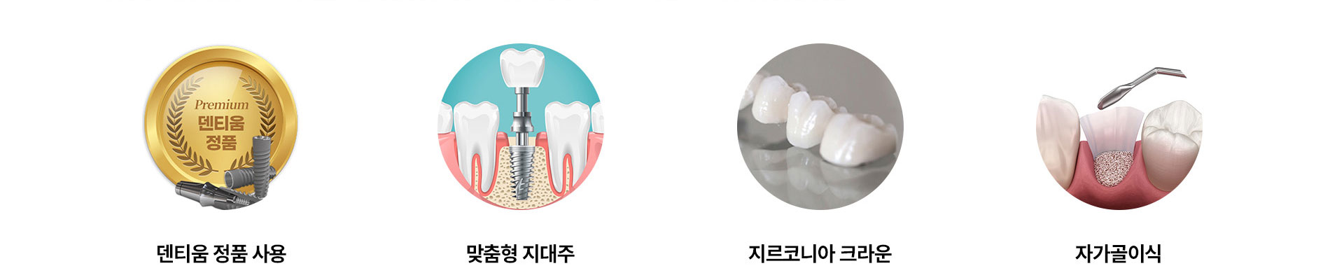 덴티움 정품 사용, 맞춤형 지대주, 지르코니아 크라운, 자가골이식