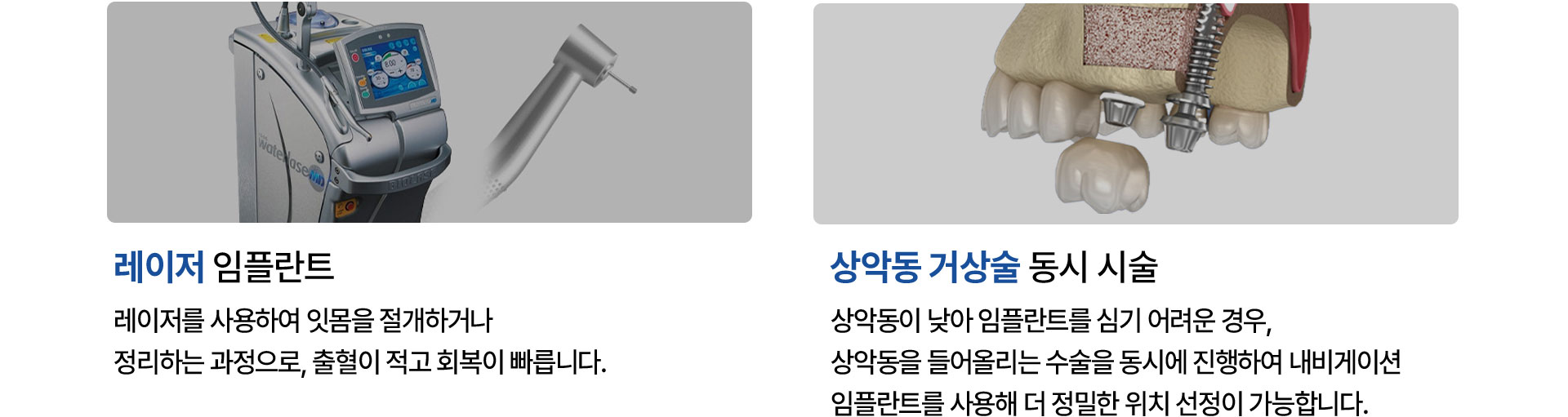 레이저 임플란트, 상악동 거상술 동시 임플란트