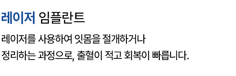 레이저 임플란트