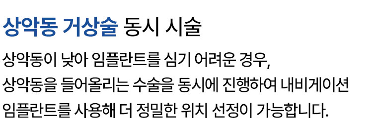 상악동 거상술