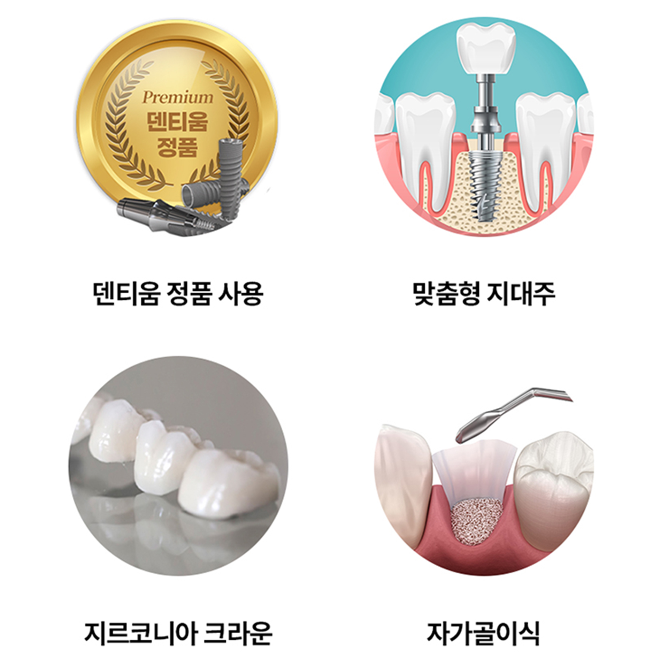 덴티움 정품 사용, 맞춤형 지대주, 지르코니아 크라운, 자가골 이식